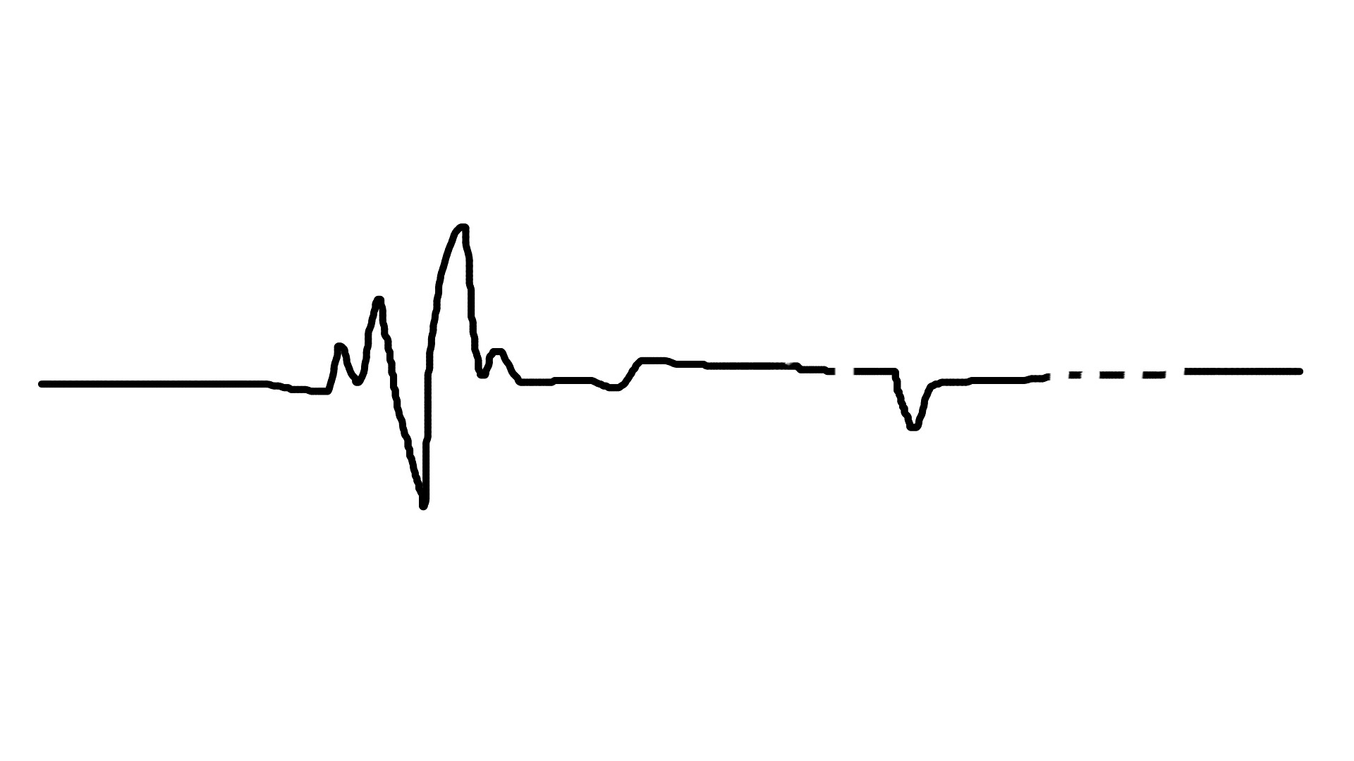 Images Of Heartbeat Drawing Simple